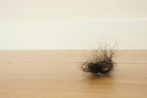 istock women lost hair drops on floor 2195667368
