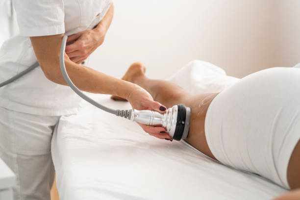 Body treatment, RF lifting hardware massage on the legs of a young woman stock photo