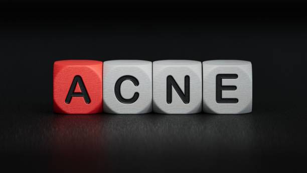 istock ACNE. Text abbreviation on wood cubes blocks. Most commonly diagnosed mental disorder of childrenBusiness Concept.3D rendering on black background. 2195942967