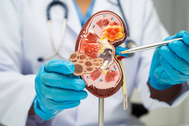istock Chronic kidney disease, doctor with model for treatment urinary system, urology, Estimated glomerular filtration rate eGFR. 2196137740