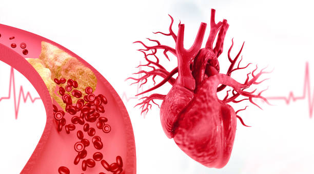 istock Cholesterol blocked artery with human heart 2196141448