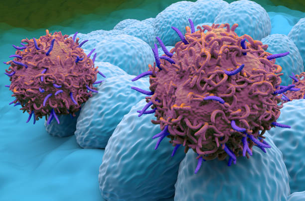 CAR T cell therapy in Endometrial cancer - closeup view 3d illustration stock photo