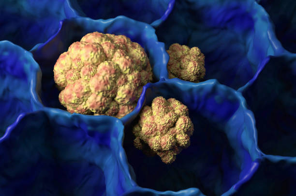 Lung cancer (LC) in the lung tissue – closeup view 3d illustration stock photo