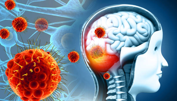 istock Brain viral infection, Viral meningitis and encephalitis. 3d illustration 2196186607