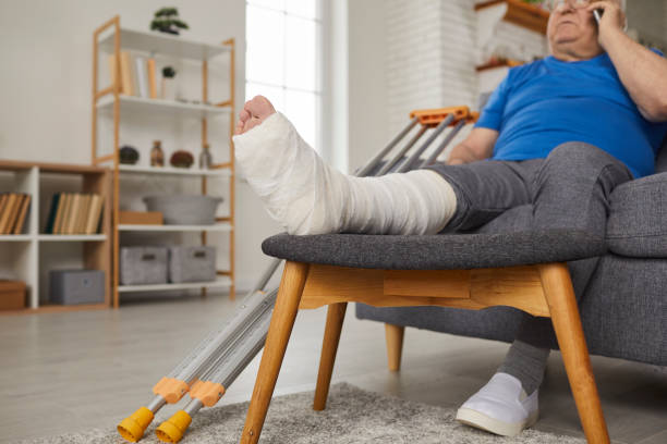 Senior man with broken leg in plaster cast sitting on couch and talking on phone stock photo