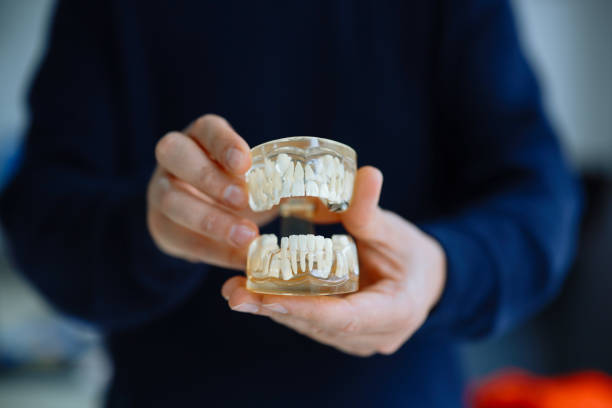 istock Doctor shows the problem with the gums on the tooths model. 2196408004