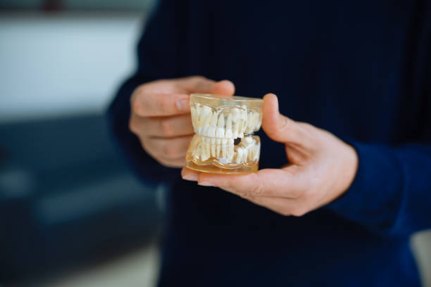 istock Doctor shows the problem with the gums on the tooths model. 2196409047