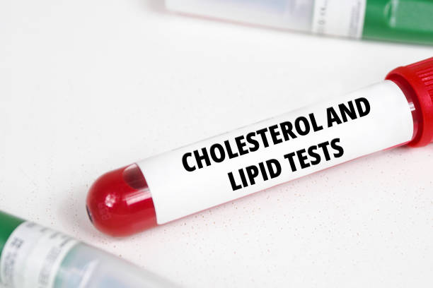 istock Cholesterol and lipid tests title text of medical analysis 2196515468