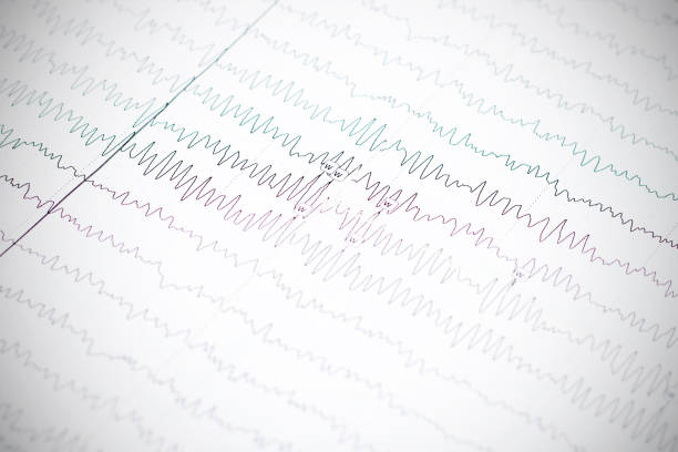 Eeg Pattern Example Printable Graph 4,900+ Eeg Pattern Stock Photos, Pictures & Royalty-Free Images - iStock