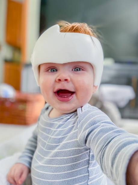 istock Baby wearing head shaping helmet 2196656059
