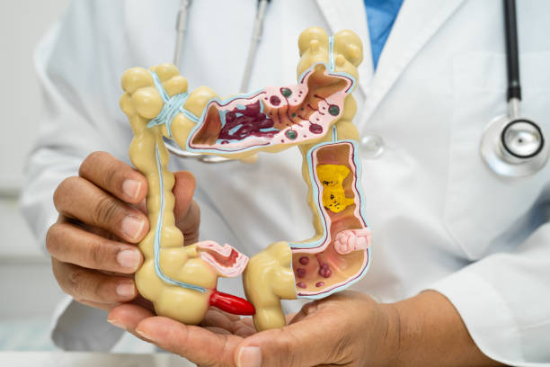 istock Intestine, appendix and digestive system, doctor holding anatomy model for study diagnosis and treatment in hospital. 2196690468
