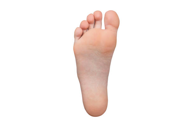 An Asian woman extra right toe.
