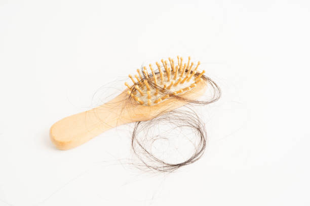 istock Hair loss fall with comb brush isolated on white background. 2197002880
