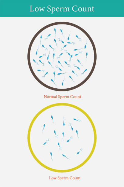 Untitled-1 normal and low sperm count illustration. Male infertility oligospermia. Structure of the sperm. Vector. eps 10 tadpole swimming stock illustrations