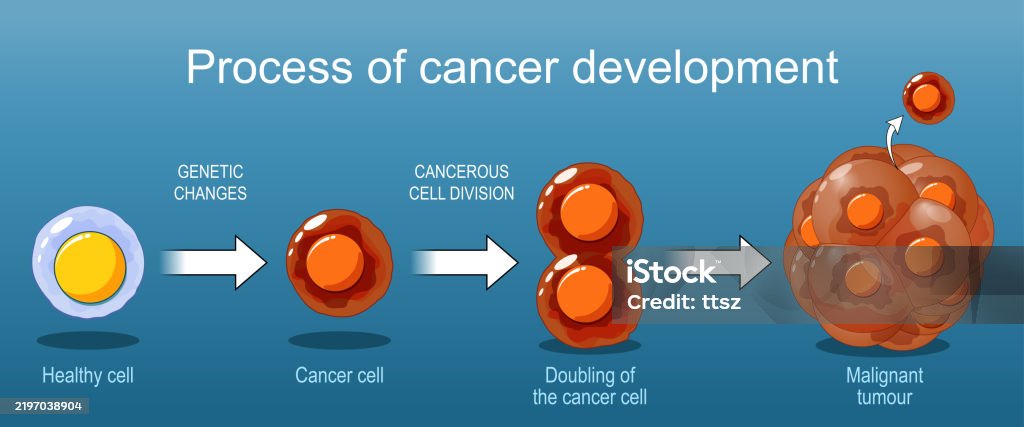 Cancer Development Cdc Cancer Development Stock Illustration - Download Image Now - Cancer ...
