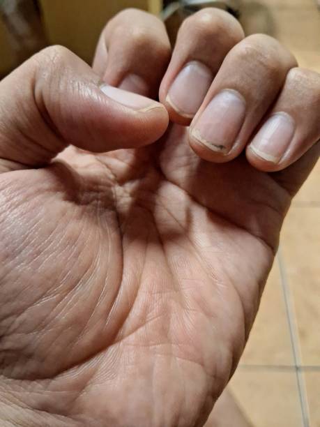 istock a dirty hand and nails 2197052725