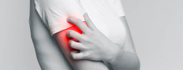 istock Woman scratching her shoulder with red rash 2197058352
