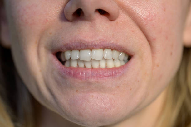 istock Close-Up of Smiling Teeth 2197180317