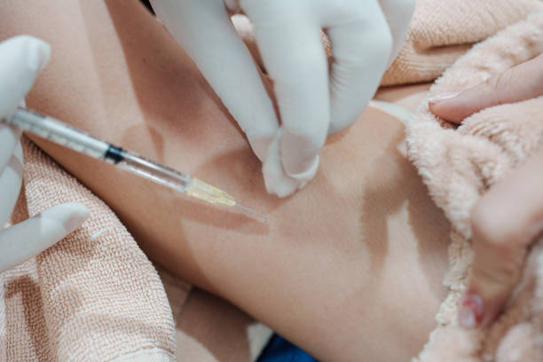 istock Medical specialist injecting syringe bacterial toxin botulin into armpit for reduce body odor and wrinkles 2197438980