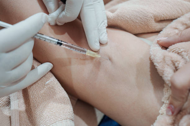 istock Medical specialist injecting syringe bacterial toxin botulin into armpit for reduce body odor and wrinkles 2197438990