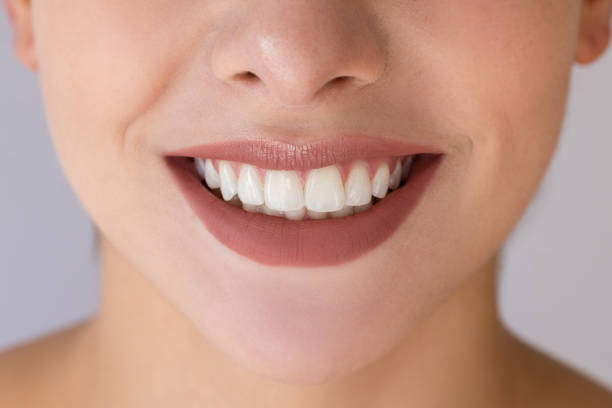 istock Woman smiling with mouth wide open 2197464035