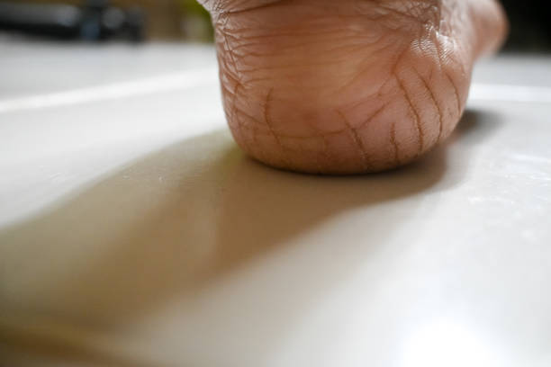 istock Close up of Cracks on Heels. 2197585014