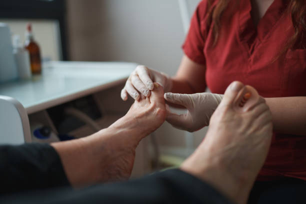 istock Podiatrist examining patient's bunion. 2197763322