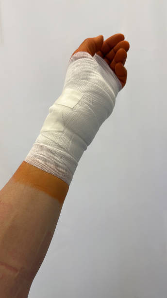 istock Wound suture body surgery operation bandage 2198021089