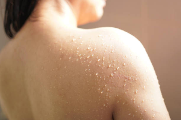 istock Close-up Water drops on the shoulder 2198096337