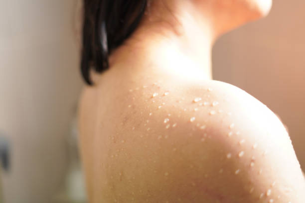 istock Close-up Water drops on the shoulder 2198096355