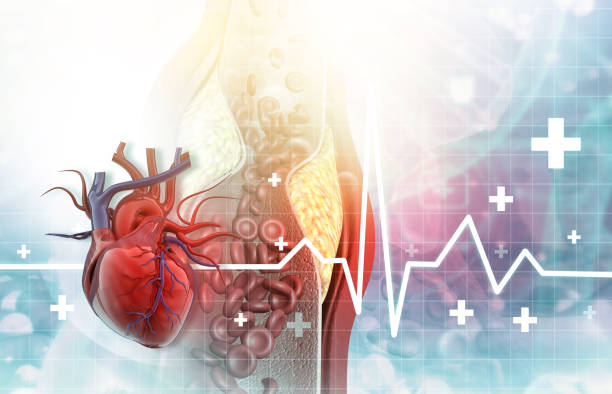 istock Cholesterol blocked artery with human heart, ecg graph 2198122973