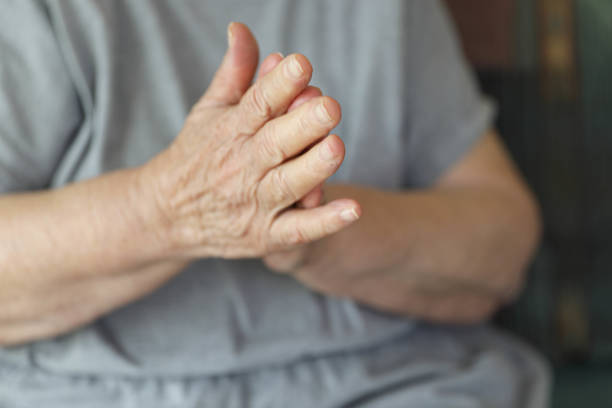 istock Hands of an Elderly Woman Applying Cream 2198146283