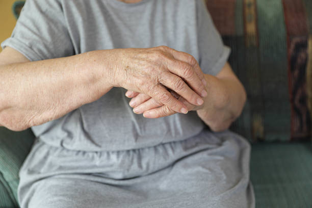 istock Hands of an Elderly Woman Applying Cream 2198146288