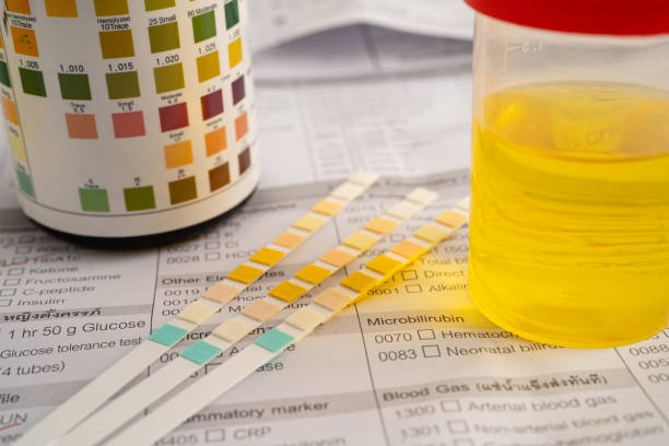istock Urinalysis, urine cup with reagent strip pH paper test and comparison chart in laboratory. 2198164102