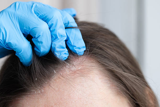 istock Consultation and exam with the doctor. Problems with skin. 2198174744