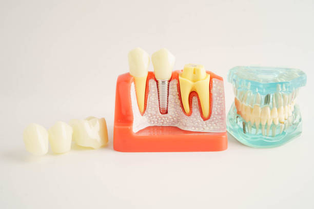 istock Dental teeth model on white background for learn about dentistry. 2198193674