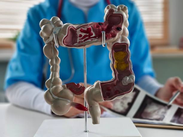 istock Detailed model of the human digestive system intestine 2198640735