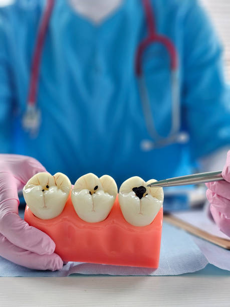 istock Dentist demonstrates dental procedures on tooth models during a training session at a dental 2198641537