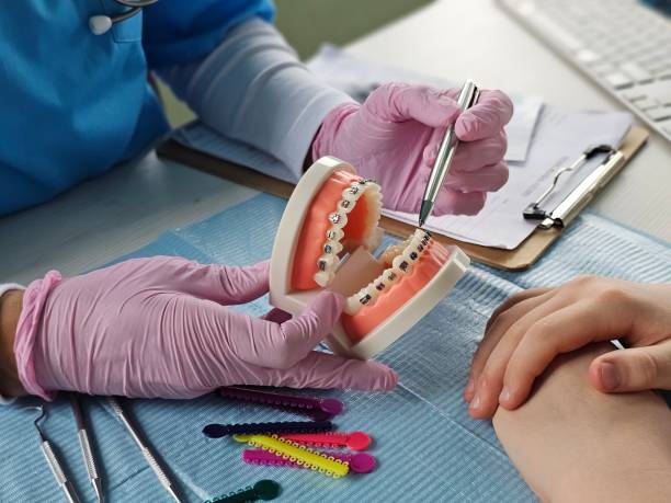 istock Orthodontic consultation demonstrating braces application with dental 2198642103