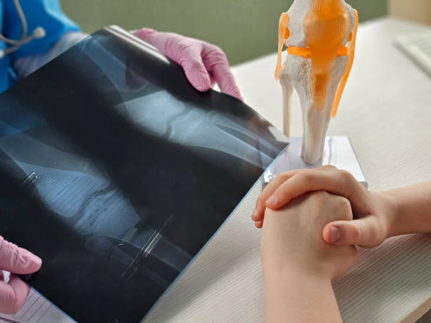 istock Doctor examines knee X-ray while explaining to child with knee 2198642508