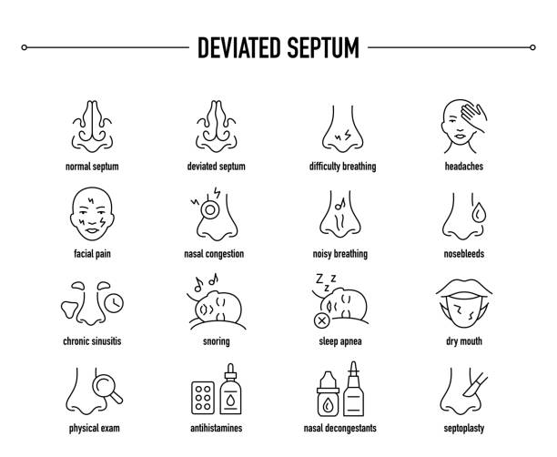 ilustraciones, imágenes clip art, dibujos animados e iconos de stock de síntomas del tabique desviado, conjunto de iconos de vectores de diagnóstico y tratamiento - senos-paranasales