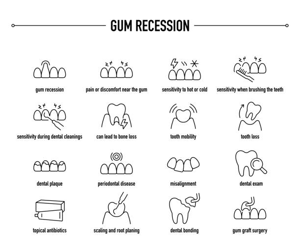Gum Recession symptoms, diagnostic and treatment vector icon set Gum Recession vector icon set. Line editable medical icons. gingivoplasty stock illustrations
