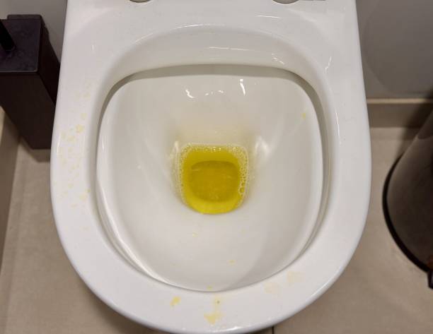 istock Unwashed toilet bowl with waste. Close-up 2198751780