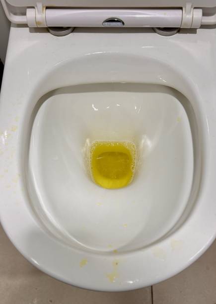 istock Unwashed toilet bowl with waste. Close-up 2198752154