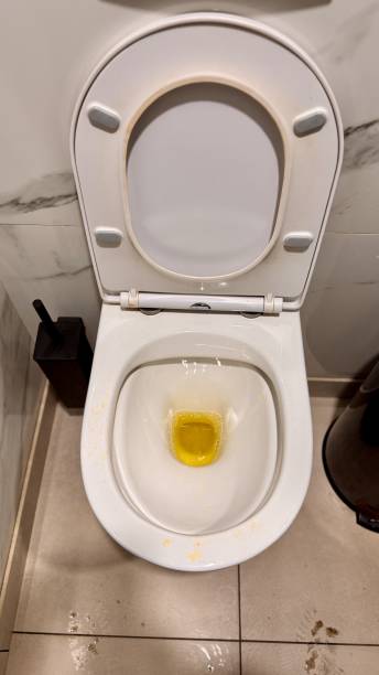 istock Unwashed toilet bowl with waste. Close-up 2198753569