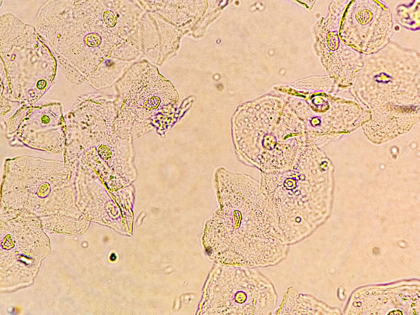 istock Epithelial cells with bacteria in patient urine (urinary tract infections). Analyze by microscope. 2198846709