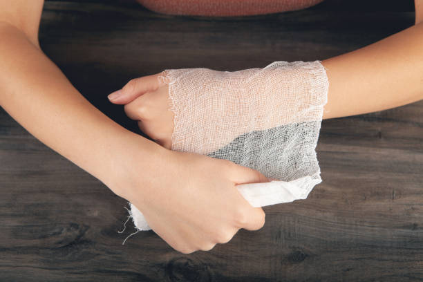 istock young woman bandages her hand 2198858629