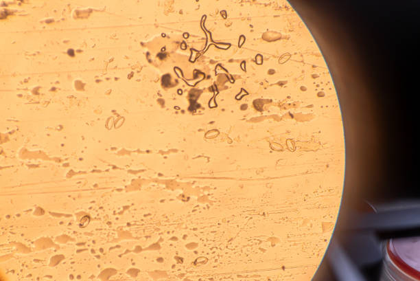 Close up view under the microscope. Close up of worm eggs and bacteria