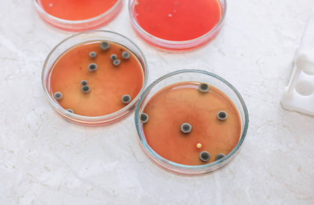 petri dish with agar and bacteria. At background blurred, biotechnological laboratory. Hand in glove holding plate with microorganisms