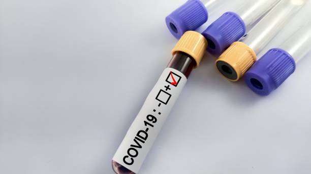 istock Coronavirus Covid 19 infected blood sample in sample tube 2199369174